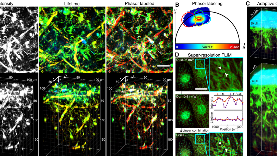Instant FLIM enables 4D in vivo lifetime imaging of intact and injured zebrafish and mouse brains